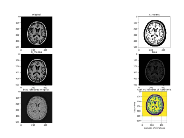 Preview image for the project NeuroCluster